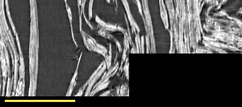 A raw CT slice through the best-scoring PHerc1203 pocket at 2.4 micron, with a 1 mm scale bar. The papyrus is torn and frayed — swirling, tangled fibers with dark voids between them, not flat continuous layers.